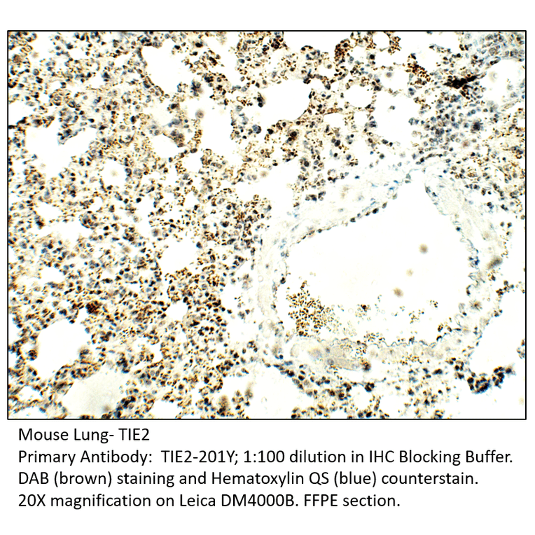 Anti-TIE2 Antibody from FabGennix (TIE2-201Y) - Antibodies.com