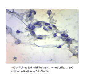 Anti-TLR1 Antibody from FabGennix (TLR-112AP) - Antibodies.com