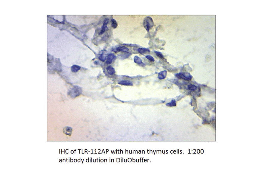 Anti-TLR1 Antibody from FabGennix (TLR-112AP) - Antibodies.com