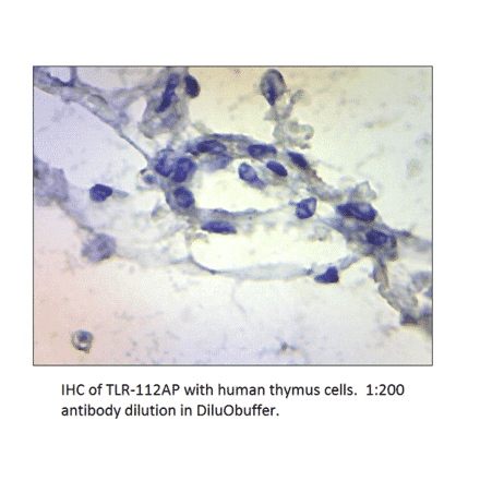 Anti-TLR1 Antibody from FabGennix (TLR-112AP) - Antibodies.com