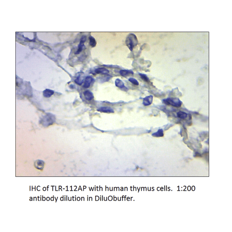 Anti-TLR1 Antibody from FabGennix (TLR-112AP) - Antibodies.com