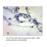 Anti-TLR1 Antibody from FabGennix (TLR-112AP) - Antibodies.com