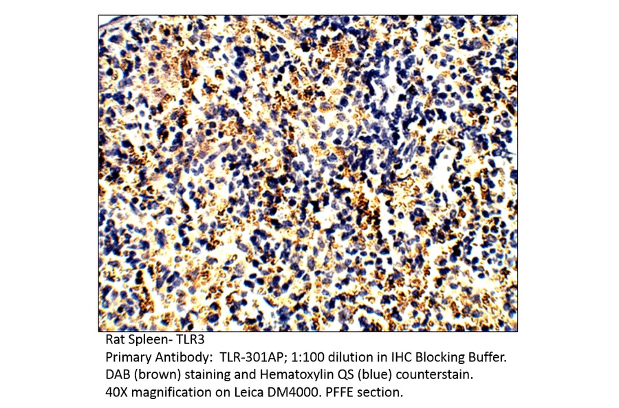 Anti-TLR3 Antibody from FabGennix (TLR-301AP) - Antibodies.com