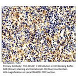 Anti-TLR3 Antibody from FabGennix (TLR-301AP) - Antibodies.com