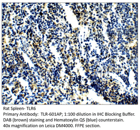 Anti-TLR6 Antibody from FabGennix (TLR-601AP) - Antibodies.com