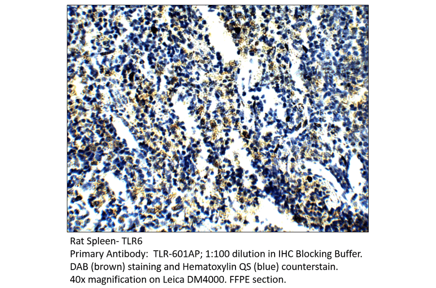 Anti-TLR6 Antibody from FabGennix (TLR-601AP) - Antibodies.com
