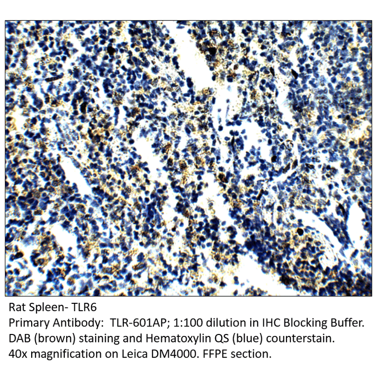 Anti-TLR6 Antibody from FabGennix (TLR-601AP) - Antibodies.com