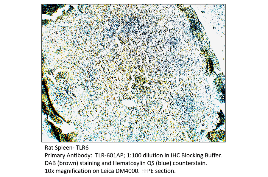 Anti-TLR6 Antibody from FabGennix (TLR-601AP) - Antibodies.com
