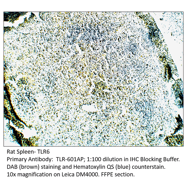 Anti-TLR6 Antibody from FabGennix (TLR-601AP) - Antibodies.com
