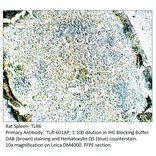 Anti-TLR6 Antibody from FabGennix (TLR-601AP) - Antibodies.com