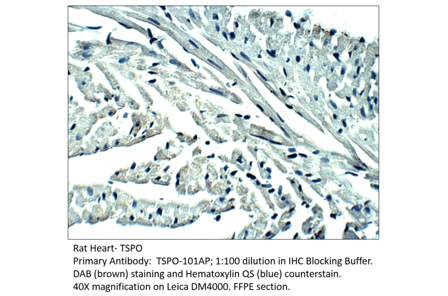Anti-PBR Antibody from FabGennix (TSPO-101AP) - Antibodies.com