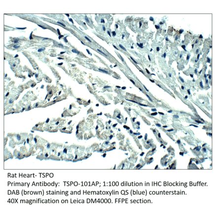 Anti-PBR Antibody from FabGennix (TSPO-101AP) - Antibodies.com