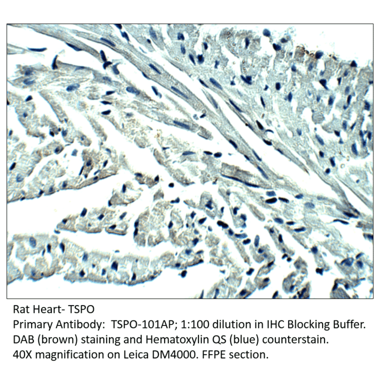 Anti-PBR Antibody from FabGennix (TSPO-101AP) - Antibodies.com