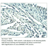 Anti-PBR Antibody from FabGennix (TSPO-101AP) - Antibodies.com