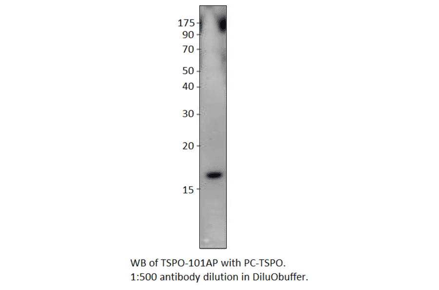 Anti-PBR Antibody from FabGennix (TSPO-101AP) - Antibodies.com