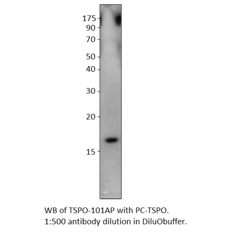 Anti-PBR Antibody from FabGennix (TSPO-101AP) - Antibodies.com