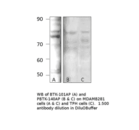 Anti-BTK Antibody from FabGennix (BTK-101AP) - Antibodies.com