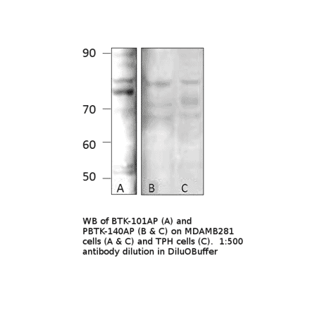 Anti-BTK Antibody from FabGennix (BTK-101AP) - Antibodies.com