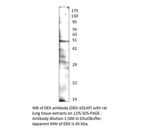 Anti-DEK Antibody from FabGennix (DEK-101AP) - Antibodies.com