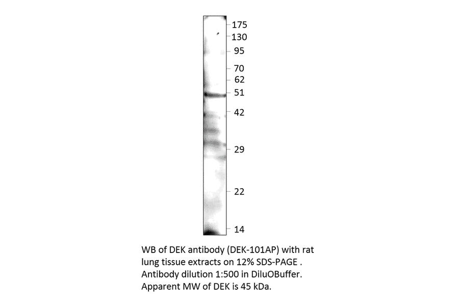 Anti-DEK Antibody from FabGennix (DEK-101AP) - Antibodies.com
