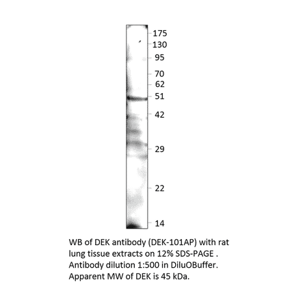 Anti-DEK Antibody from FabGennix (DEK-101AP) - Antibodies.com