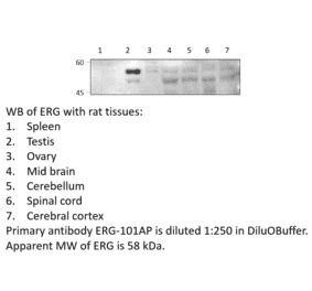 Anti-ERG Antibody from FabGennix (ERG-101AP) - Antibodies.com