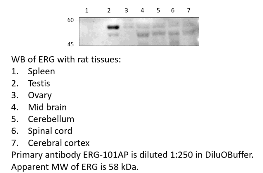 Anti-ERG Antibody from FabGennix (ERG-101AP) - Antibodies.com