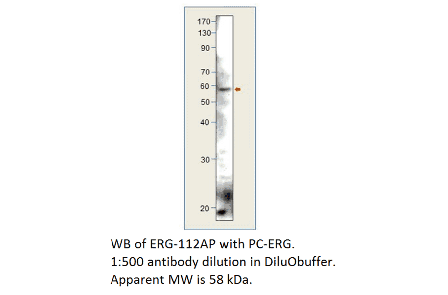 Anti-ERG Antibody from FabGennix (ERG-112AP) - Antibodies.com