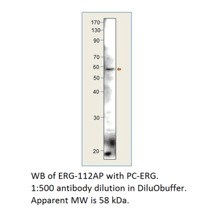 Anti-ERG Antibody from FabGennix (ERG-112AP) - Antibodies.com