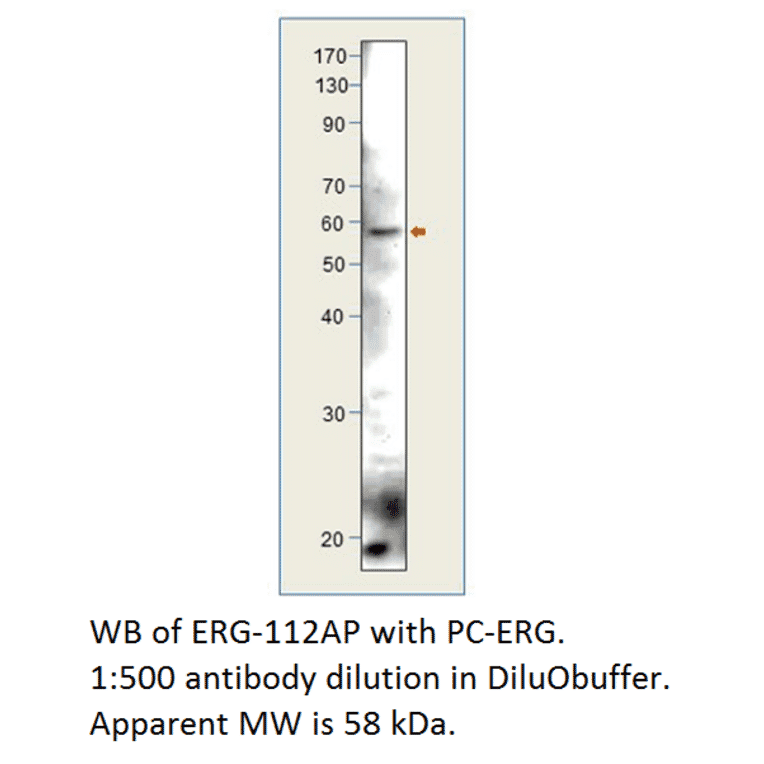 Anti-ERG Antibody from FabGennix (ERG-112AP) - Antibodies.com