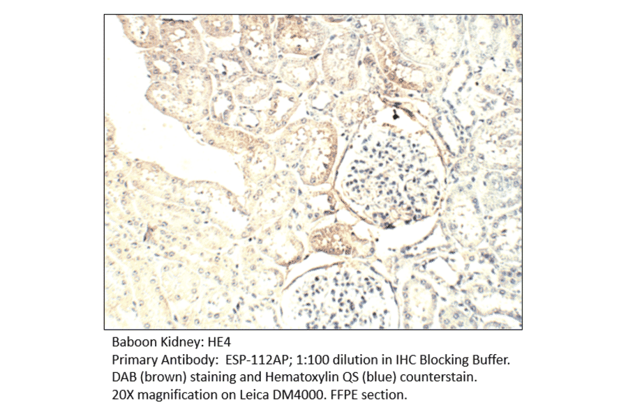 Anti-HE4 Antibody from FabGennix (ESP-112AP) - Antibodies.com
