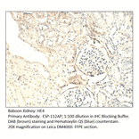 Anti-HE4 Antibody from FabGennix (ESP-112AP) - Antibodies.com