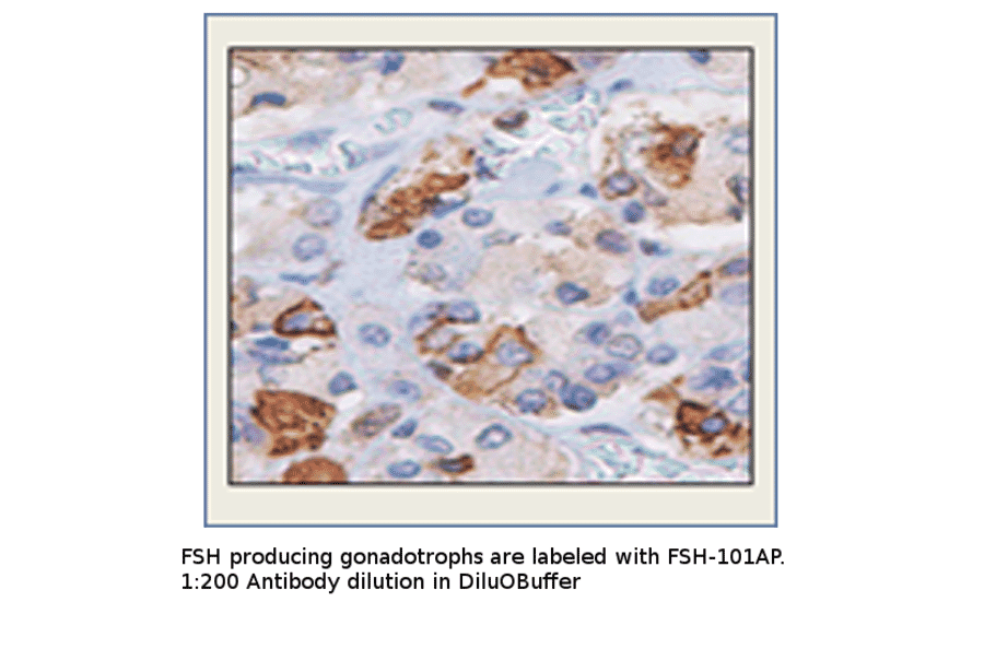 Anti-FSH Antibody from FabGennix (FSH-101AP) - Antibodies.com