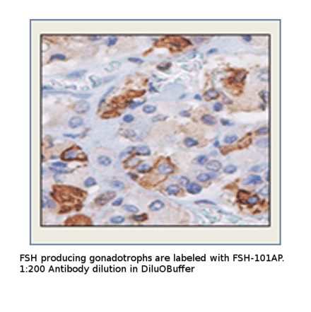 Anti-FSH Antibody from FabGennix (FSH-101AP) - Antibodies.com