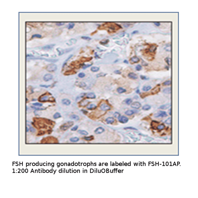 Anti-FSH Antibody from FabGennix (FSH-101AP) - Antibodies.com