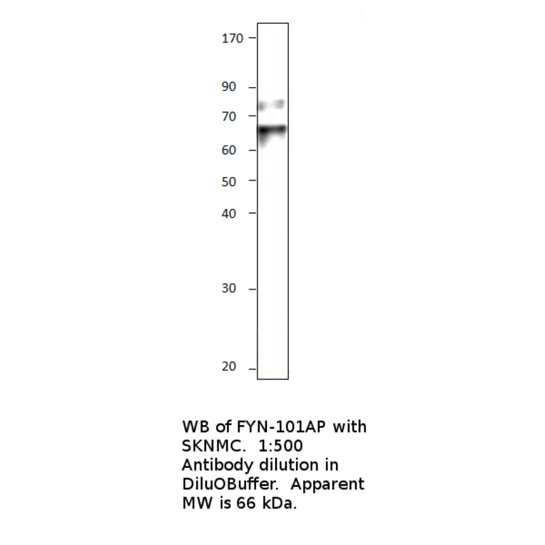 Anti-FYN Antibody from FabGennix (FYN-101AP) - Antibodies.com