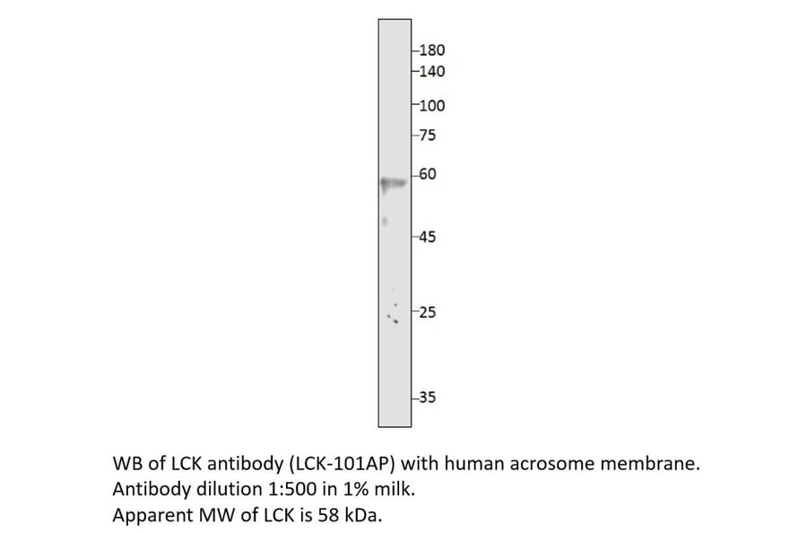 Anti-Lck Antibody from FabGennix (LCK-101AP) - Antibodies.com
