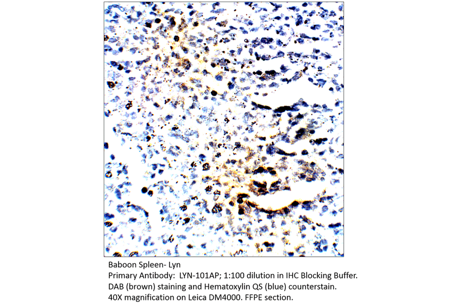 Anti-Lyn Antibody from FabGennix (LYN-101AP) - Antibodies.com