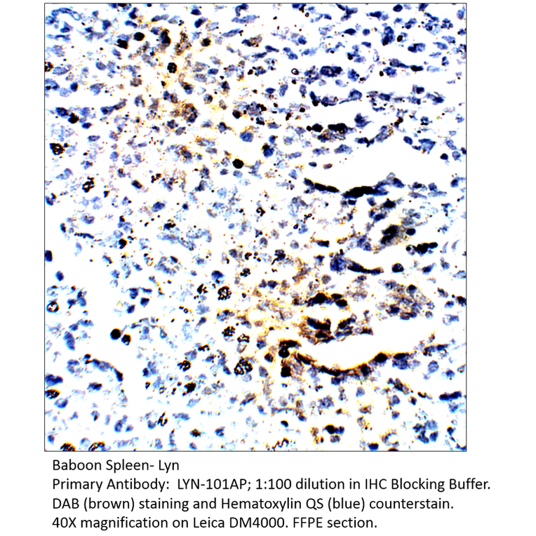 Anti-Lyn Antibody from FabGennix (LYN-101AP) - Antibodies.com