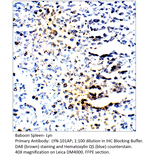 Anti-Lyn Antibody from FabGennix (LYN-101AP) - Antibodies.com