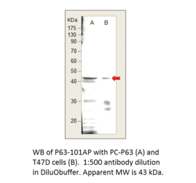Anti-p63 Antibody from FabGennix (P63-101AP) - Antibodies.com