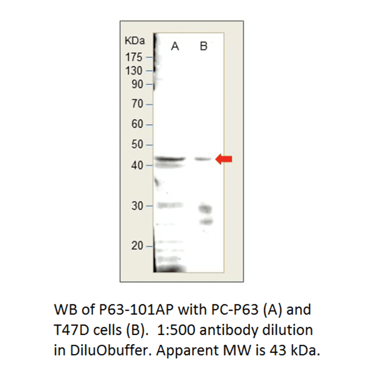 Anti-p63 Antibody from FabGennix (P63-101AP) - Antibodies.com