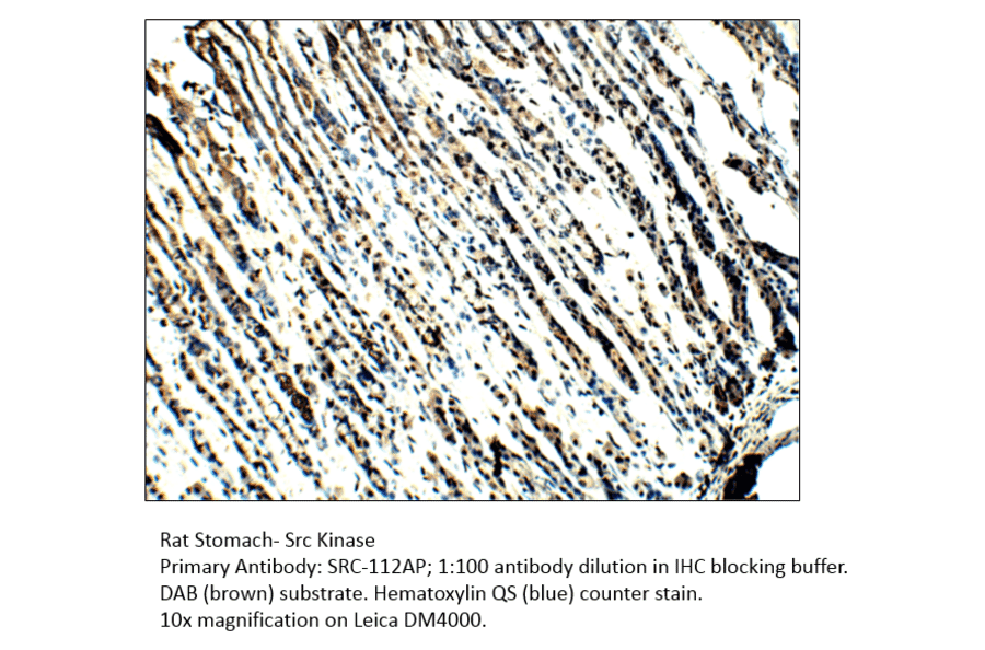 Anti-Src Antibody from FabGennix (Src-112AP) - Antibodies.com