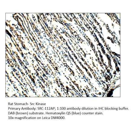 Anti-Src Antibody from FabGennix (Src-112AP) - Antibodies.com