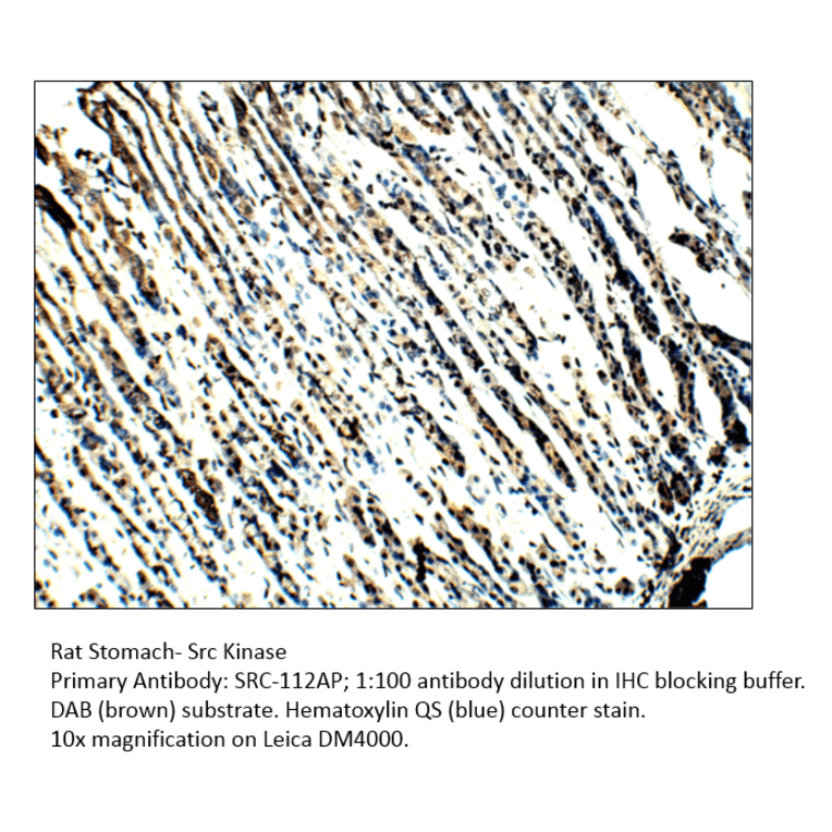 Anti-Src Antibody from FabGennix (Src-112AP) - Antibodies.com