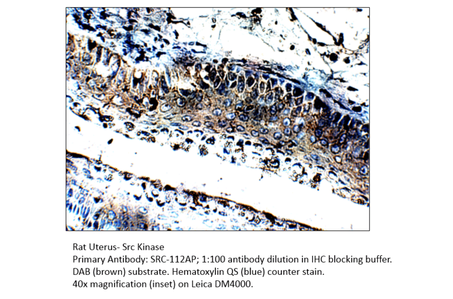 Anti-Src Antibody from FabGennix (Src-112AP) - Antibodies.com