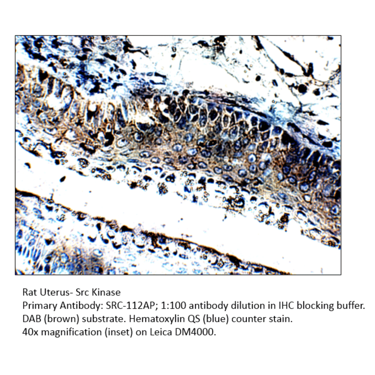 Anti-Src Antibody from FabGennix (Src-112AP) - Antibodies.com