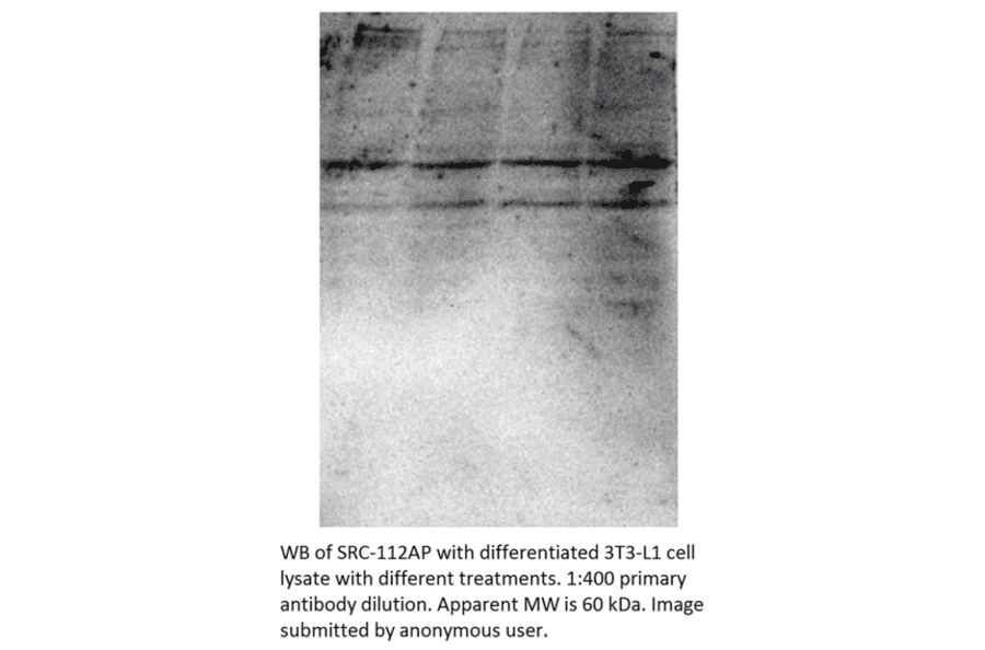 Anti-Src Antibody from FabGennix (Src-112AP) - Antibodies.com