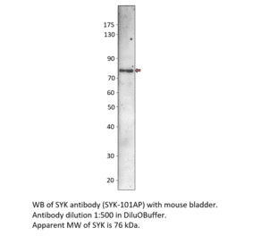 Anti-Syk Antibody from FabGennix (SYK-101AP) - Antibodies.com