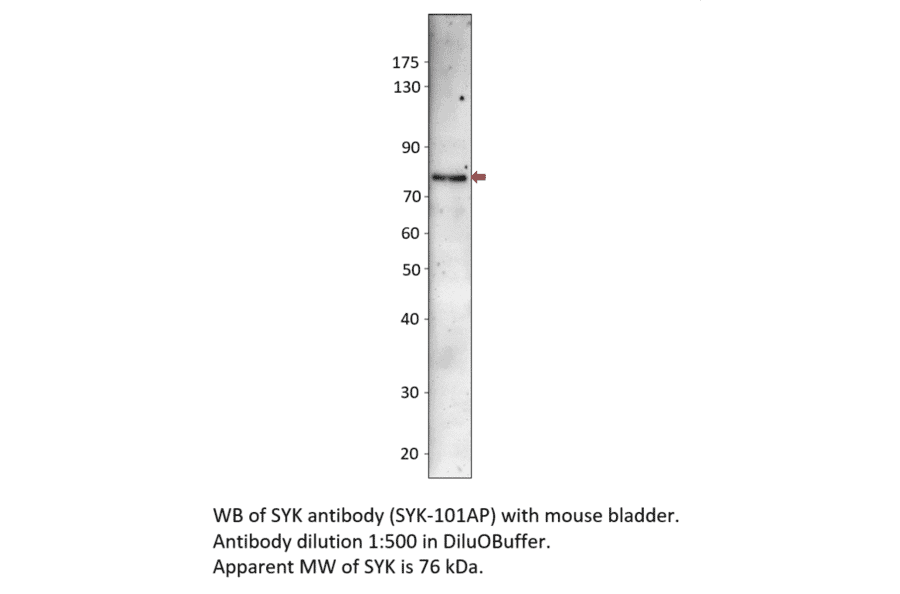 Anti-Syk Antibody from FabGennix (SYK-101AP) - Antibodies.com